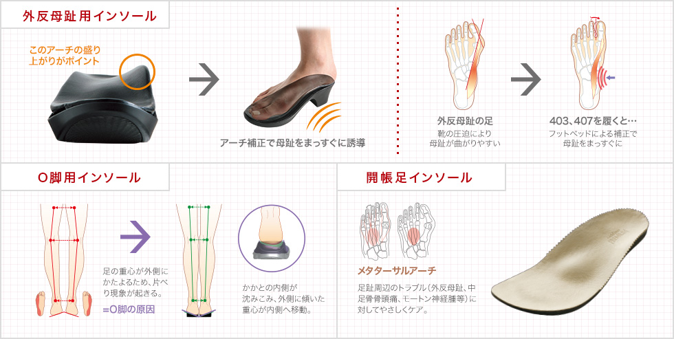 外反母趾用インソール、O脚用インソール、開帳足インソール